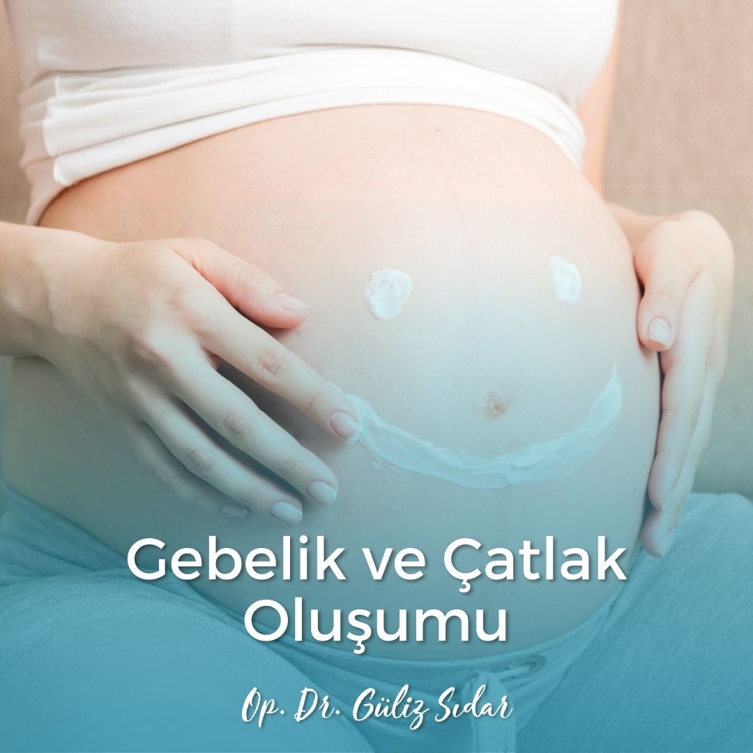 Gebelik ve atlak Oluumu