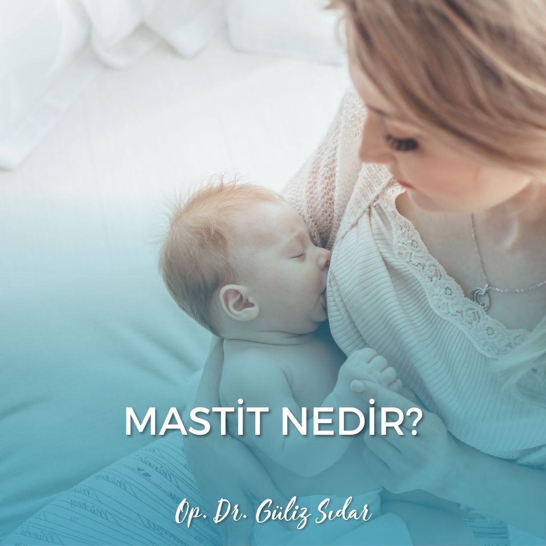 Mastit Nedir?