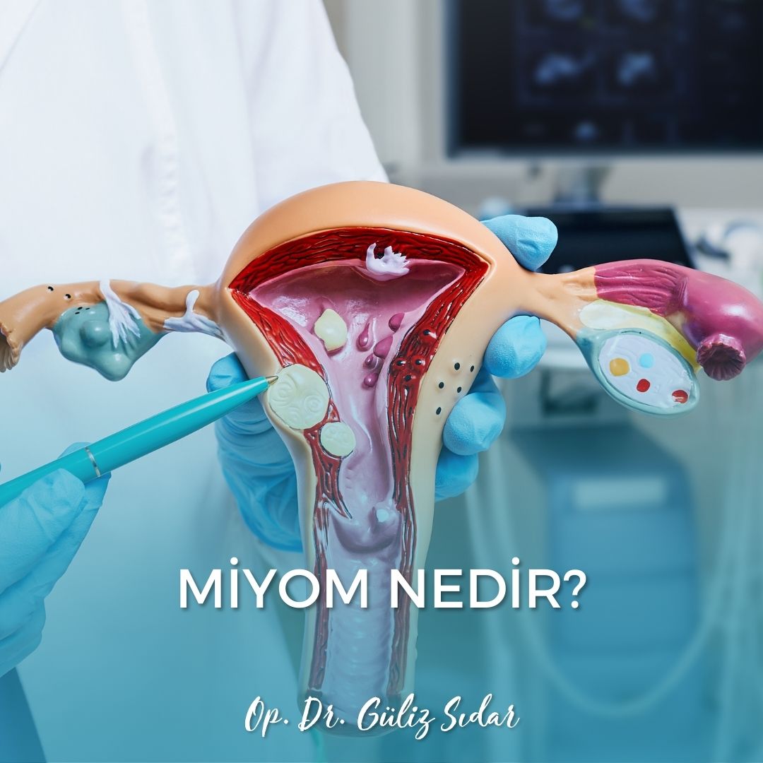 Miyom Nedir?